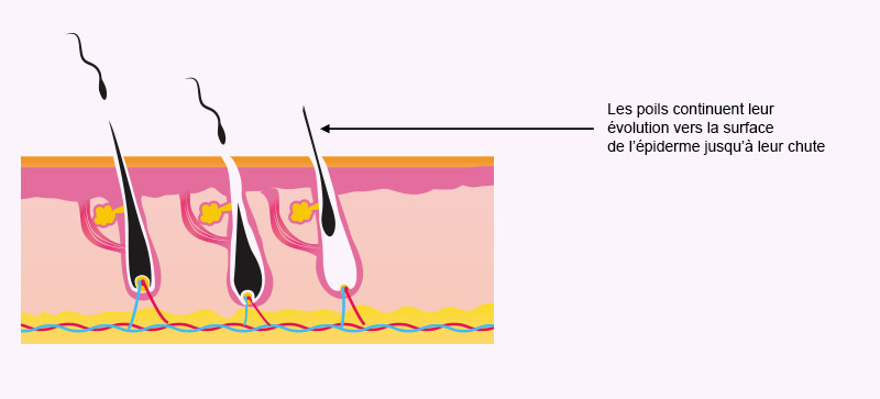 Schéma de la chute du poil après la séance d'épilation au laser