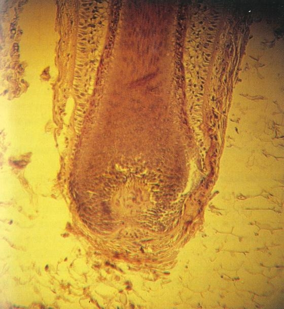 vue en coupe longitudinale d'une racine de follicule pileux humain